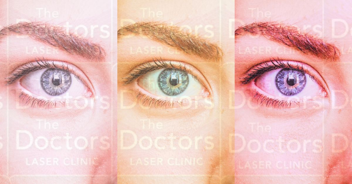 eye treatments at the doctors laser clinic