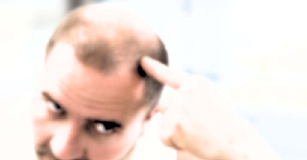 scalp lesion removal